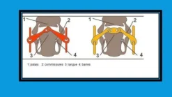 DB Maillechort Baucher